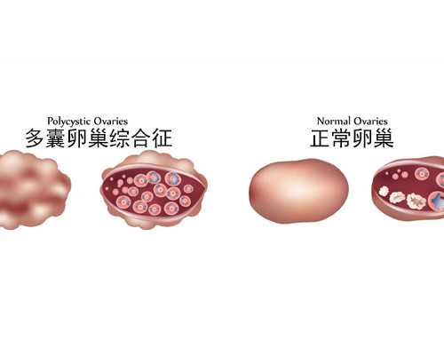 试管都去泰国？因为有3个关键点导致成功率高