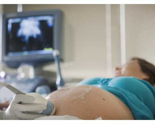 牛奶是准成都助孕妈妈的好食物