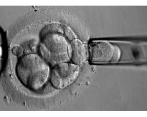 成都代生孕机构,(成都代生助孕)成都代怀生子机构有哪些？附费用详情？