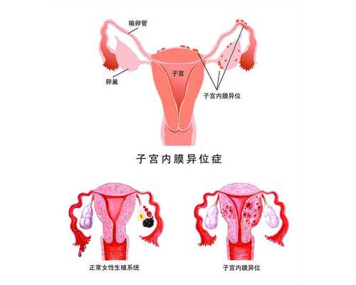 试管婴儿准妈妈,试管过程中喝水篇,全方讲解