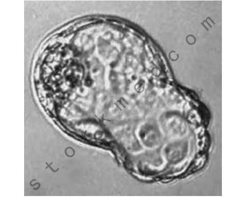 适合准成都助孕妈妈的运动有哪些？