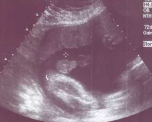 产后成都助孕妈妈的饮食禁忌