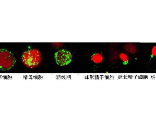 二胎成都助孕妈妈的待产包二胎成都助孕妈妈的待产包应该如何准备