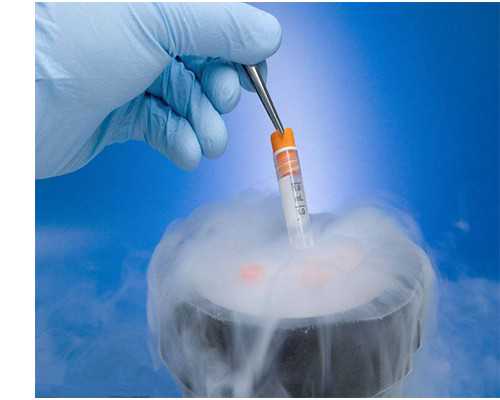 取卵后第二天别干家务活，拖地、洗衣等要视卵巢恢复而定