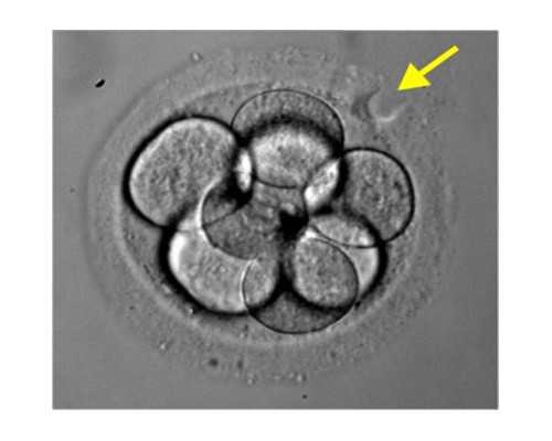 高龄怀孕风险，超过35岁得小心这5大风险-供卵助孕医院