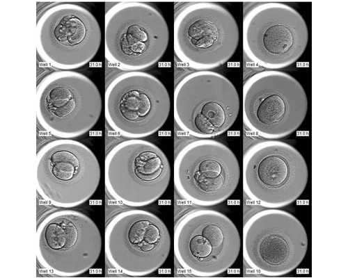 准成都助孕妈妈夏季谨防妊娠糖尿病