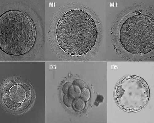 大连试管婴儿费用是多少？公司报价2436元