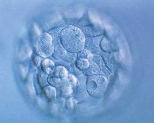 准备做试管婴儿要多长时间？