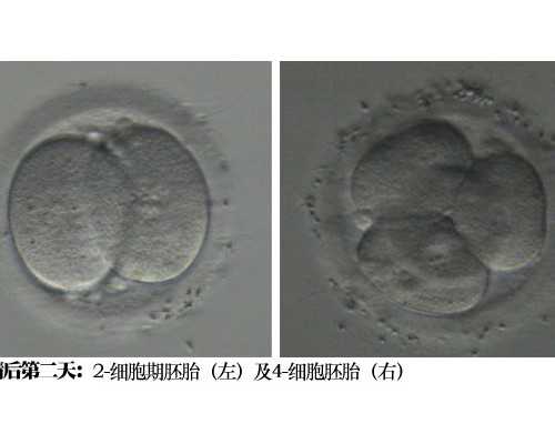 准成都助孕妈妈吃巧克力有什么好处