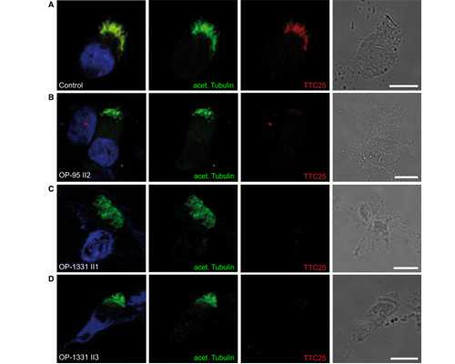 遇到“马赛克”胚胎，移植还是遗弃并非你说了算！