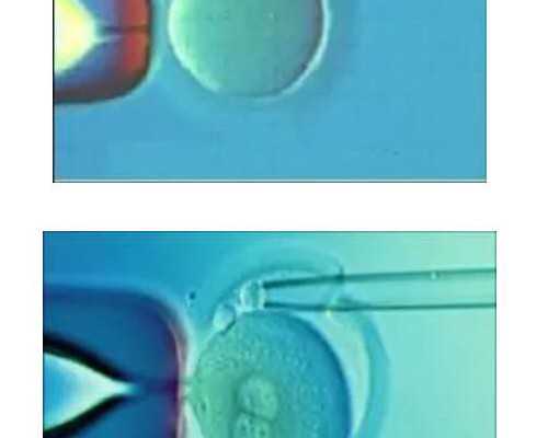 连云港妇保院生殖科做二代试管婴儿移植一次多少钱？