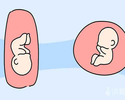 准成都助孕妈妈意想不到的流产因素