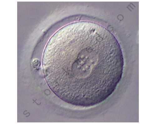 孕成都助孕妈妈便秘怎么办？