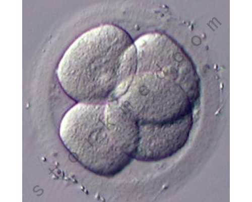 北京做试管婴儿费用多少？北京做试管贵吗？