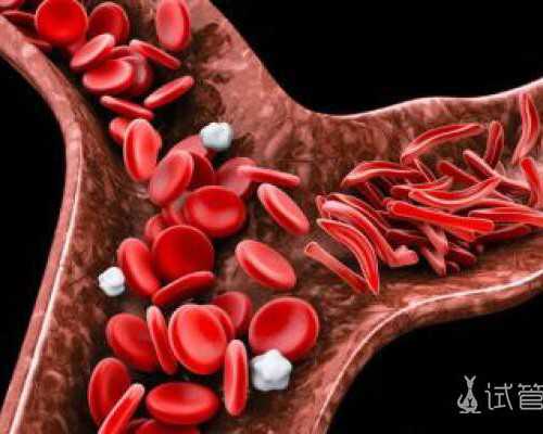 赴美试管婴儿32天,记录试管婴儿亲身经历