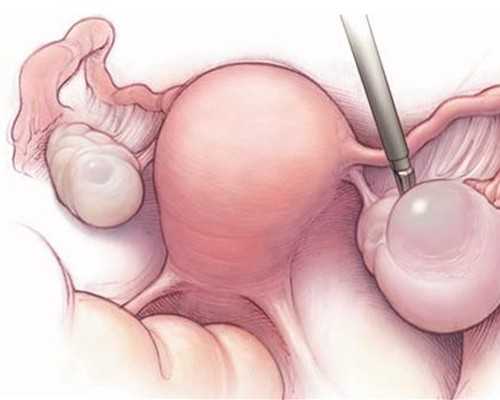 准成都助孕妈妈如何抵御严寒的冬天