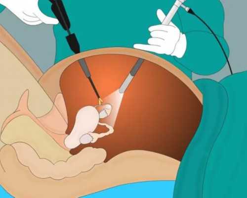 有效激发准成都助孕妈妈食欲的食谱