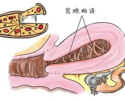 孕成都助孕妈妈可以吃葡萄吗？