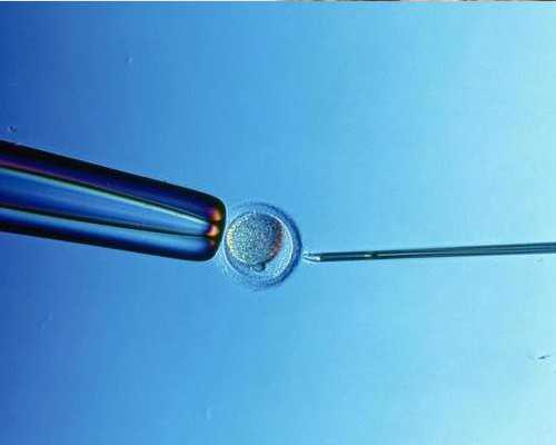 试管双胞胎要不要减胎你说了不算，关键得看这5点