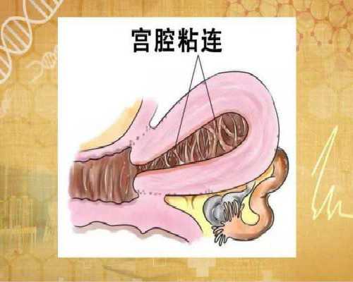 俄罗斯试管收费解析，这四个费用标准提前了解