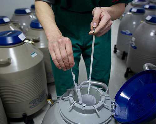 禁欲提高精子质量