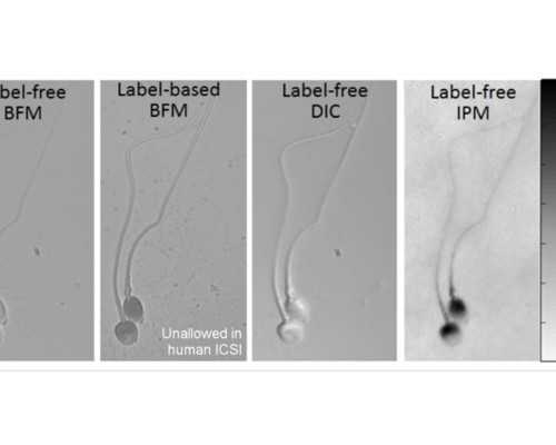 为什么要进行生育力评估？对于做试管有什么影响吗？