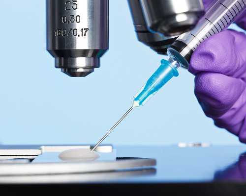 出现卵黄囊说明什么