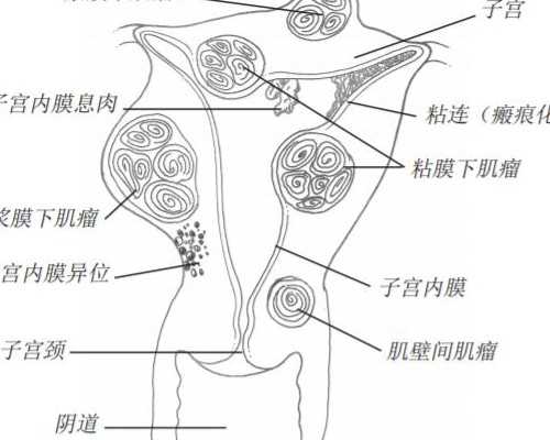 雅培成都助孕妈妈喜康素好吗
