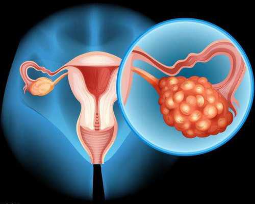 【单亲成都助孕妈妈】单亲成都助孕妈妈的生活？单亲成都助孕妈妈孩子户口