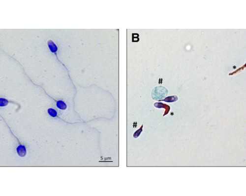 试管婴儿成功率是否与女性年龄有关？