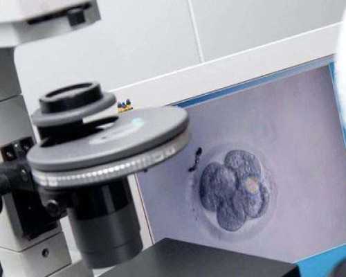 美国试管婴儿相关的激素六项、阴超检查你知道吗？