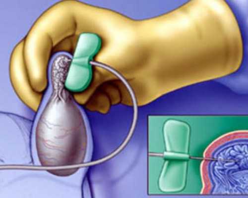 补锌什么时候吃效果好