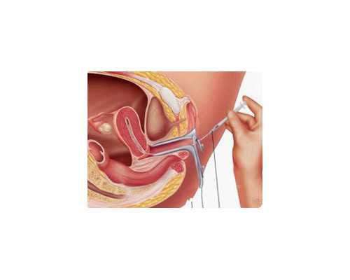 乙肝成都助孕妈妈早知道