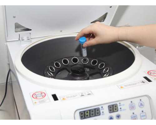 无痛分娩为什么不提倡？无痛分娩怎么样？