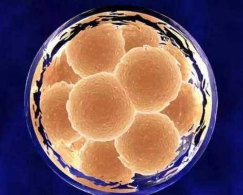 孕早期出血不建议盲目保胎，这4种情况请寻求医生帮助