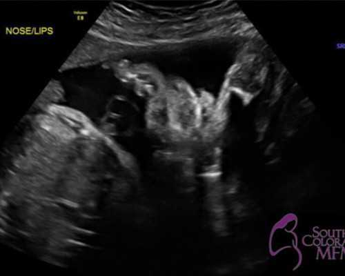 惠氏成都助孕妈妈孕妇奶粉