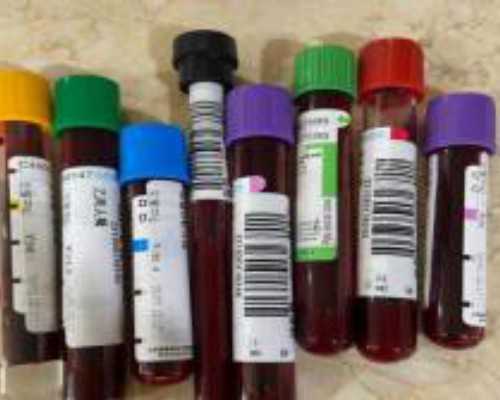 患有宫颈癌能活多久