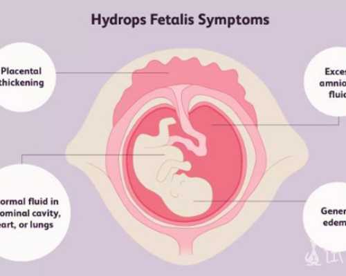 单身成都助孕妈妈三代试管，单亲成都助孕妈妈试管