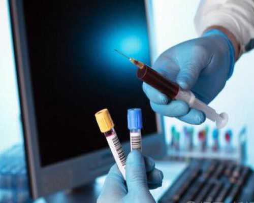 试管婴儿进周前如何评估女性卵巢功能？