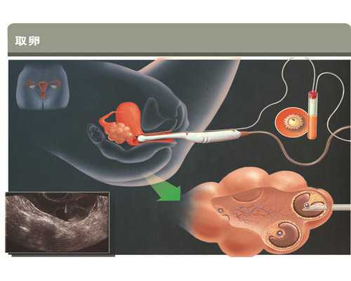 导致男性小蝌蚪质量差的原因有哪些